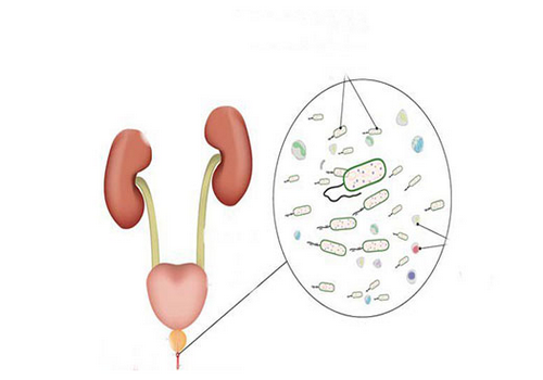 Bệnh lỗ sáo dương vật thường gặp [CHỚ NÊN CHỦ QUAN]