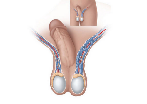 Bệnh tinh hoàn thường gặp và dấu hiệu điển hình