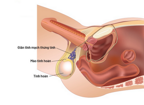 Bệnh tinh hoàn thường gặp và dấu hiệu điển hình