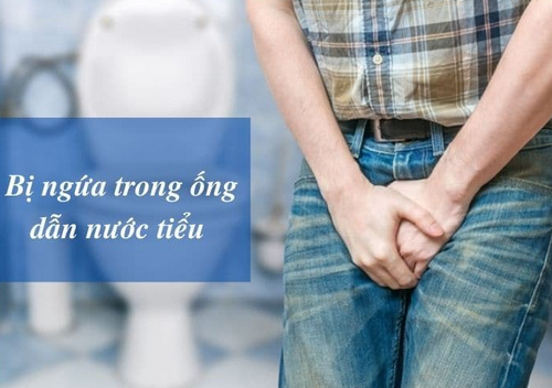 Ngứa ống dẫn tiểu: Nguyên nhân, dấu hiệu và cách khắc phục hiệu quả