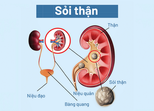 Nguyên nhân tiểu buốt và địa chỉ thăm khám bệnh uy tín?