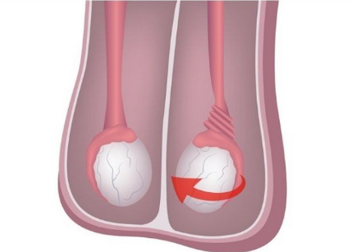 Sa, xệ tinh hoàn là bị làm sao, có nguy hiểm không?