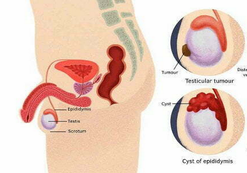 Tinh hoàn: Cấu tạo, chức năng và một số bệnh thường gặp