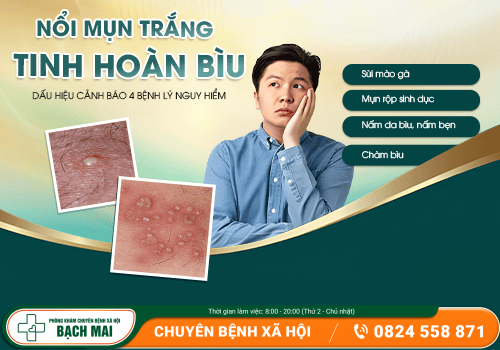 Nổi mụn trắng tinh hoàn bìu – Dấu hiệu cảnh báo 4 bệnh lý nguy hiểm