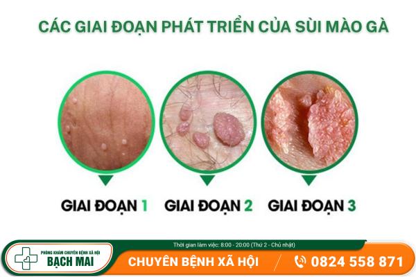 Cảnh giác với tình trạng hạt trắng sinh dục ở nam giới 10
