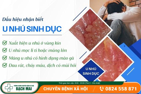 Dấu hiệu nhận biết u nhú sinh dục