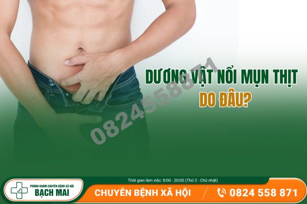 duong vat noi mun thit